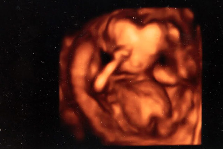 ภาพอัลตร้าซาวด์ 4มิติ ทารกบอกรักแม่ตั้งแต่อยู่ในท้อง