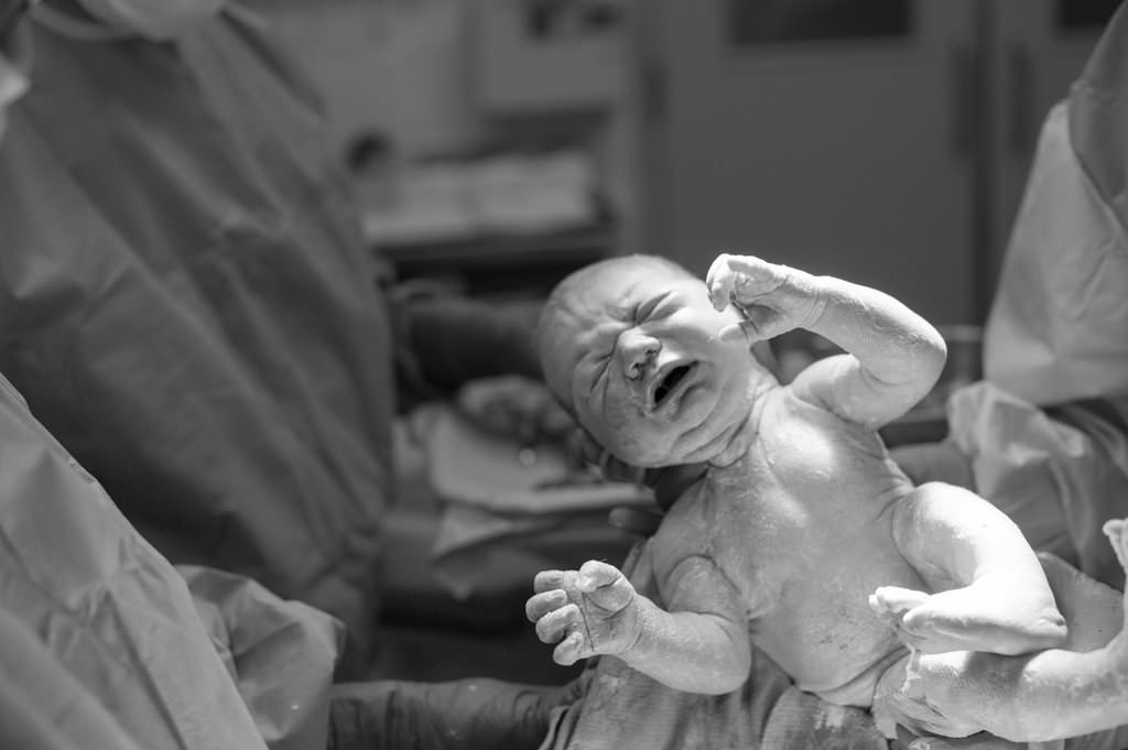 C-Section-Birth-Photo10