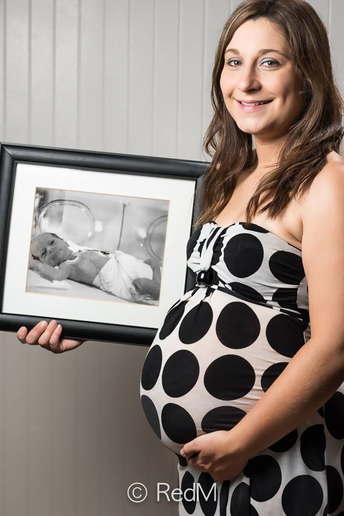 Tamica เกิดตอนอายุ 32 สัปดาห์ (และภาพนี้ถ่ายตอนที่เธอกำลังตั้งครรภ์ 26 สัปดาห์)