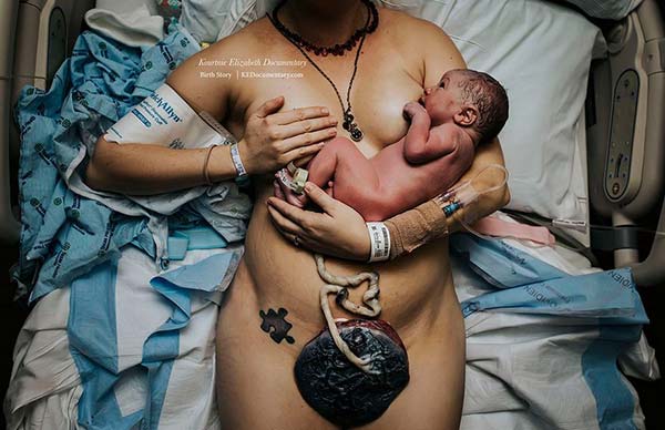 20 bức ảnh sinh nở này sẽ làm rung động trái tim của những mẹ từng đớn đau vượt cạn